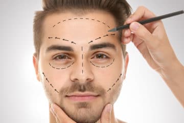 chirurgia estetica viso