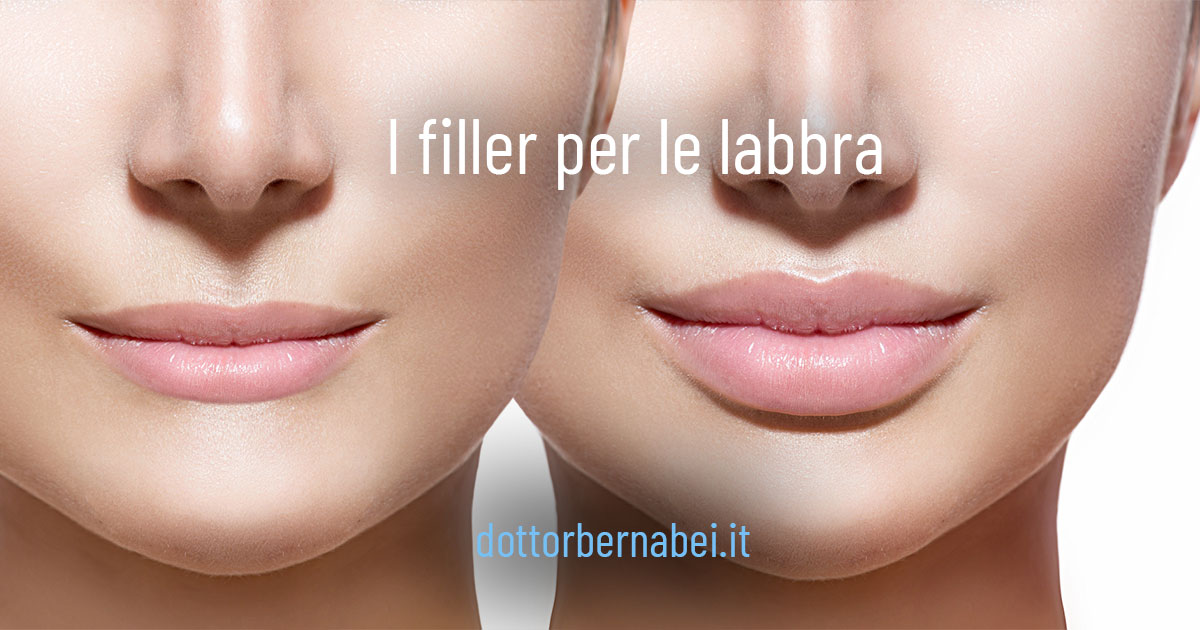 I filler per le labbra - Dr. Gianfranco Bernabei Chirurgo plastico a Milano